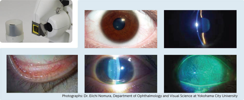 KOWA NEW MODEL SL-19 SLIT LAMP With Options - Image 2